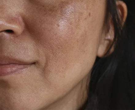 Customer skin before using the product