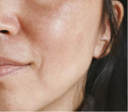 Customer skin after using the product