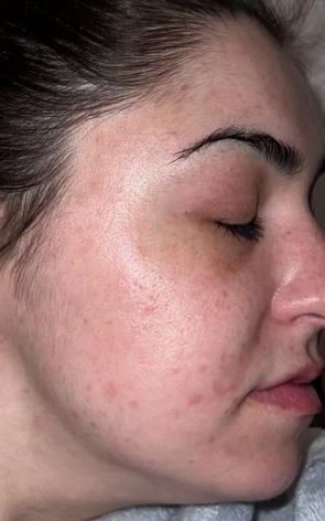 Customer skin before using the product