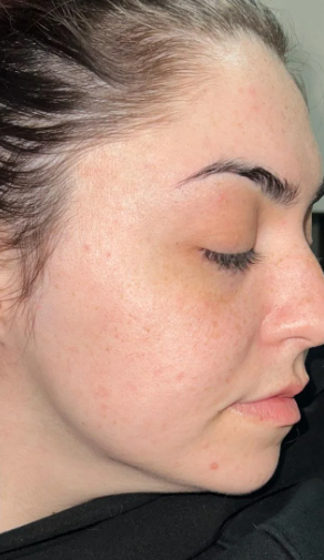 Customer skin after using the product