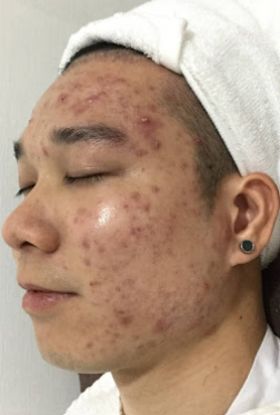 Customer skin before using the product